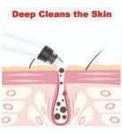 DERMA SUCTION
