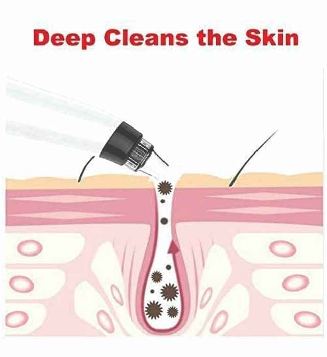 DERMA SUCTION 4