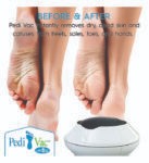 PEDI VAC (Rechargeable Electric Foot File PediVac, Callus Remover)
