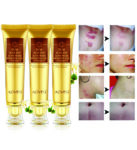 SCAR AND ACNE MARK REMOVAL