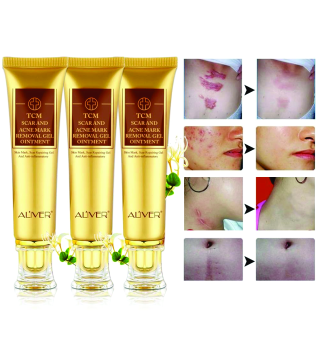 SCAR AND ACNE MARK REMOVAL 1