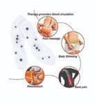 hypertension shoe pad